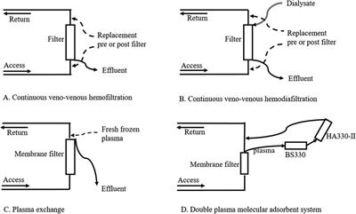 Association of duration and etiology with the effect of the artificial liver support system in pediatric acute liver failure